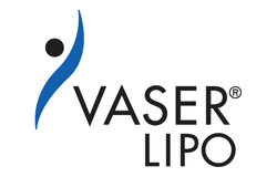 VASER® Lipo Fort Myers, FL