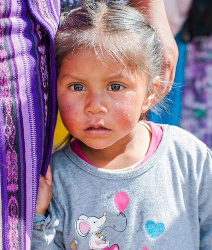 Mazza Plastic Surgery - Guatemala Mission